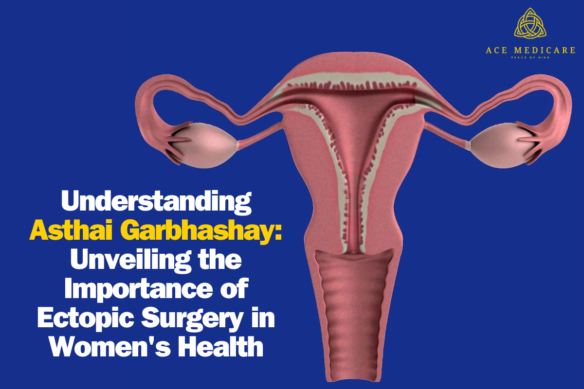 Understanding Asthai Garbhashay: Unveiling the Importance of Ectopic Surgery in Women's Health
